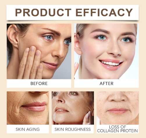 Zenbora Bee Venom Botox Cream – Erase Wrinkles & Fine Lines Naturally